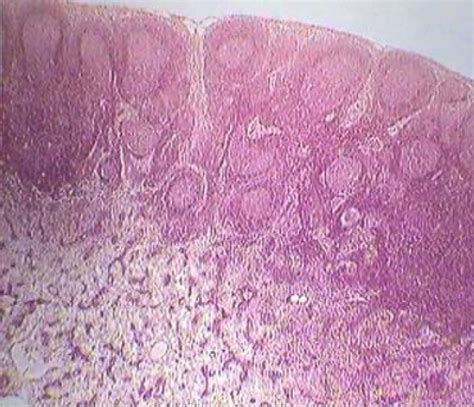 Lymph Node Histology Diagram Quizlet