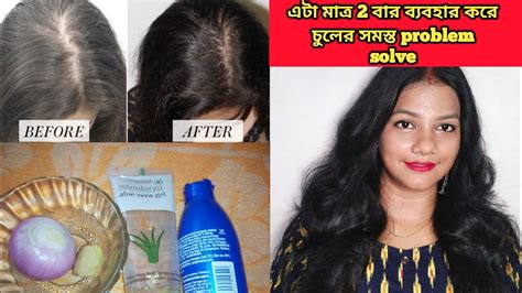 এটা 100 চুল পড়া বন্ধ করবে মাত্র 1 সপ্তাহে Homemade Hair Tonic Saj