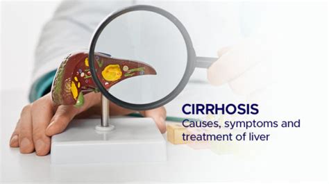 Cirrhosis: Causes, Symptoms and Treatment of Liver - AILBS India