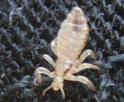 Lice Infestation from a park bench in Santa Monica - What's That Bug?