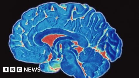 Child Brain Tumour Diagnosis Times Cut Bbc News