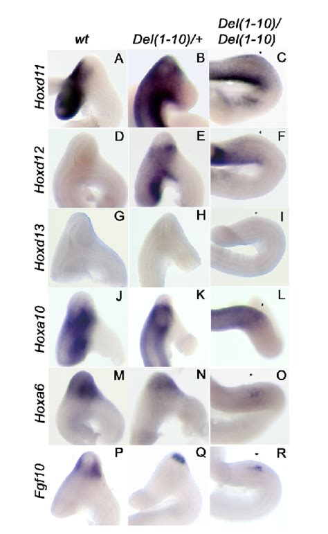 Defect In The Gut Of Del1 10 Mutants Whole Mount Rna In Situ