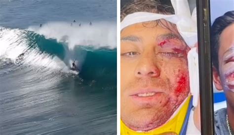 Koa Rothman Had A Very Brutal Wipeout At Pipeline