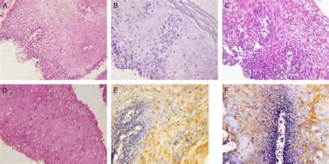 Histopathologic Findings In Esophageal Mucosa Of Gastroesophageal Download Scientific Diagram