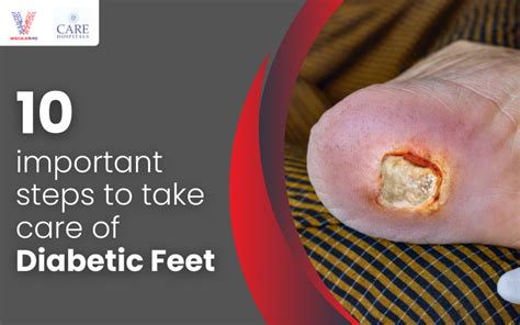 10 Important Steps To Take Care Of Diabetic Feet