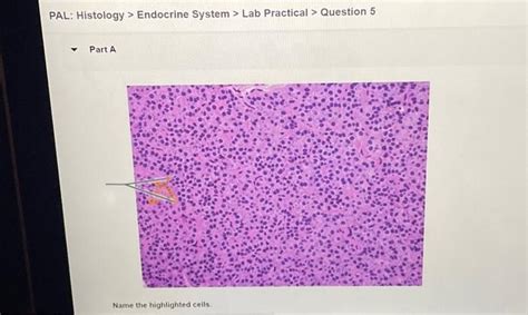 Solved Pal Histology Endocrine System Lab Practical Chegg