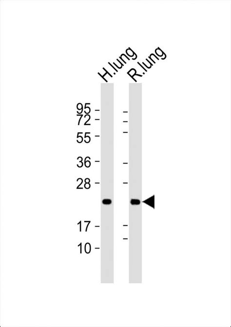 Rabbit Anti Sftpc Polyclonal Antibody N Term Absin