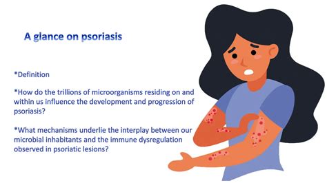 Understanding Psoriasis The Gut Skin Axis 5 Pptx