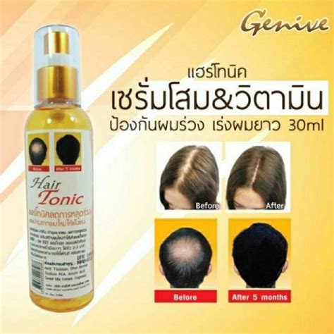 Jual Hair Tonic Genive Hair Tonic Serum Shopee Indonesia