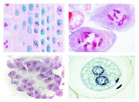 Mitosis and Meiosis Set I, 6 selected microscope slides | PHYWE