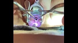 Perverse Mature Enlarge Her Cervix With Penetration Of Catheter Inflated Until Orgasm XNXX