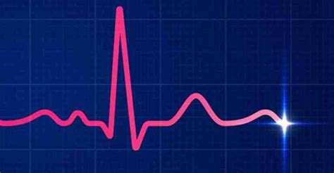 تفسیر نوار قلب آموزش خواندن نوار قلب به زبان ساده Ekg