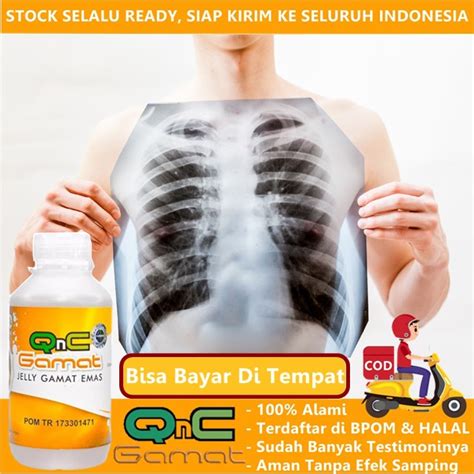 Jual Obat Flek Paru Pneumonia Radang Paru Infeksi Paru Emfisema