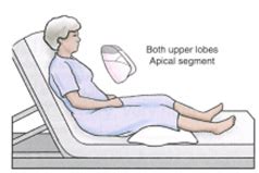 Postural Drainage Positions Flashcards Quizlet