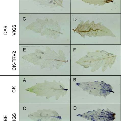 Nitroblue Tetrazolium Nbt And Diaminobenzidine Dab Staining