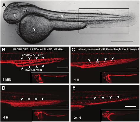 Circulation Of NPs In The Zebrafish Embryo Manual Analysis A