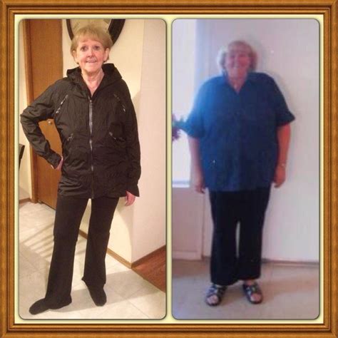 Better Body Bariatric | Bariatric Surgery 4 Health - Bariatric Surgery ...