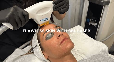 Achieving Flawless Skin With Bbl Laser At Natali Kelly Clinic Bbl