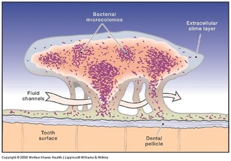 M1 Self Study Microbiology Of Perio Disease Flashcards Quizlet