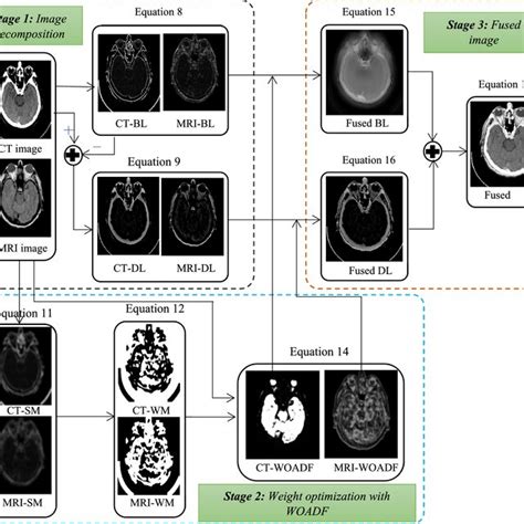 CT And MRI Multi Modal Medical Image Fusion Using Weight Optimized