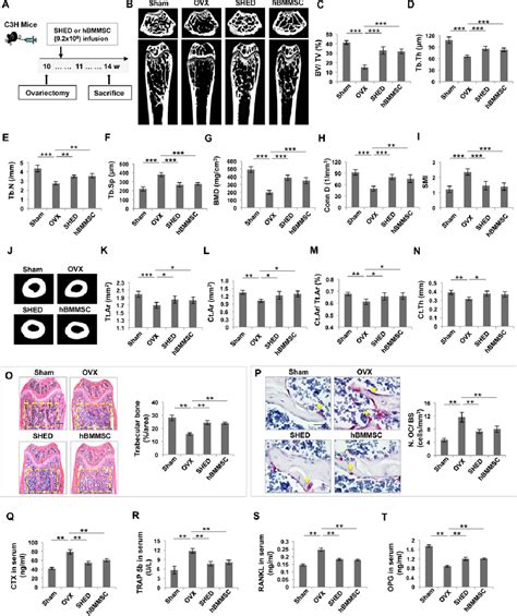 Figure 1 From Transplantation Of SHED Prevents Bone Loss In The Early