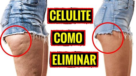 Celulite Como Eliminar Veja Como Acabar A Celulite Nas Coxas E