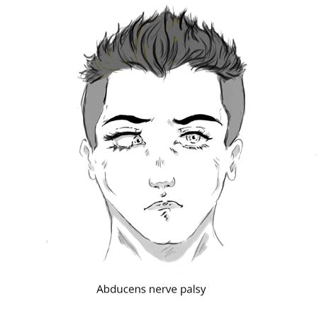 The Abducens Nerve (CN VI) - Course - Motor - TeachMeAnatomy