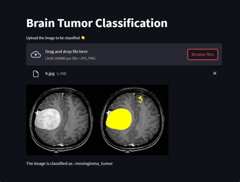 Brain Tumor Classification And Segmentation Devpost