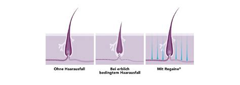 Haarausfall Regaine Frauen Besamex Ihre Apotheke Bringt S