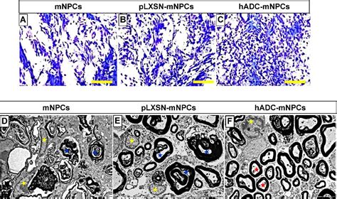 Figure 1 From Neural Stem Cells Overexpressing Arginine Decarboxylase