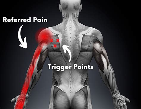 7 Causes Of Shoulder Pain And Tingling In The Fingers Facts And Physio