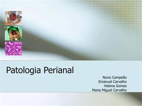 Ppt Patologia Perianal Powerpoint Presentation Free Download Id 829116