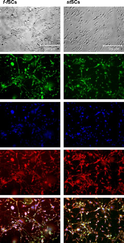 Protein Expression Analysis Of Neuronal Differentiation Markers