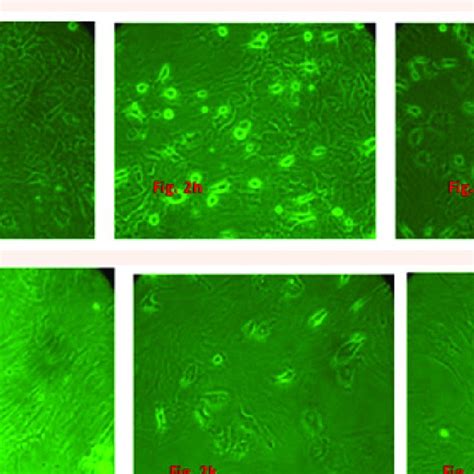 Culturing Of Rat Bone Marrow Derived Mesenchymal Stem Cells 2a P 0 Download Scientific