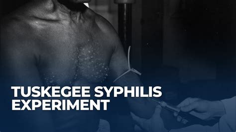 The Tuskegee Syphilis Experiment A Dark Chapter In Medical History