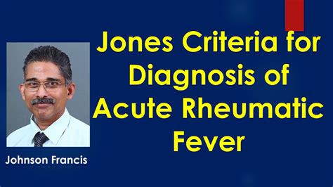 Jones Criteria For Diagnosis Of Acute Rheumatic Fever Youtube