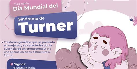 SÍNTOMAS DE SÍNDROME DE TURNER – El Regional