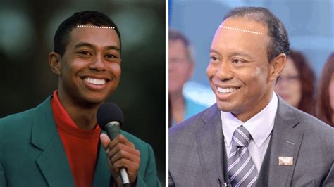 A Detailed Look Into Tiger Woods Hair History Heartafact