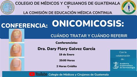 Conferencia Onicomicosis Cuándo Tratar Y Cuándo Referir Youtube