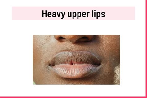 9 Different Types Of Lips Their Shapes And Sizes With Lip Chart