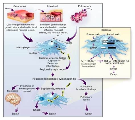 Bacillus Anthracis An Overview