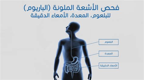 فحص الأشعة الملونة الباريوم للبلعوم المعدة الأمعاء الدقيقة