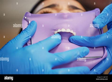 Improving Lives One Smile At A Time A Young Woman Having Dental Work