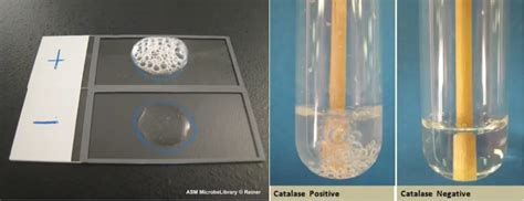 Catalase Test Principle Procedure Results Uses • Microbe Online