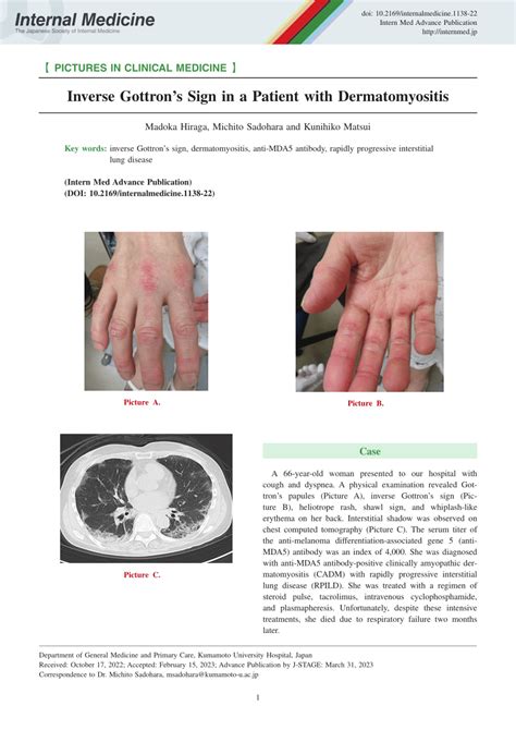 (PDF) Inverse Gottron's Sign in a Patient with Dermatomyositis