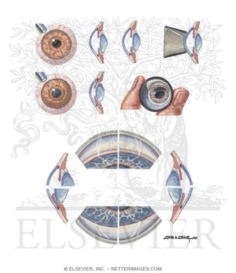 Assessment of Anterior Chamber Depth