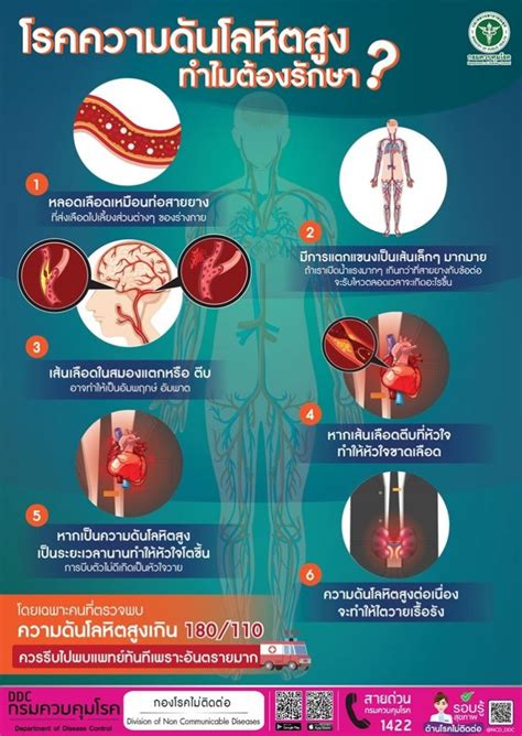 7 ล้านคน ป่วยความดันโลหิตสูงแต่ยังไม่รักษา หมอแนะประชาชนวัดค่าสม่ำเสมอ ลดเสี่ยง