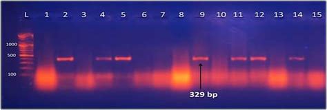 Ethidium Bromide Stained Agarose Gel Electrophoresis Of PCR