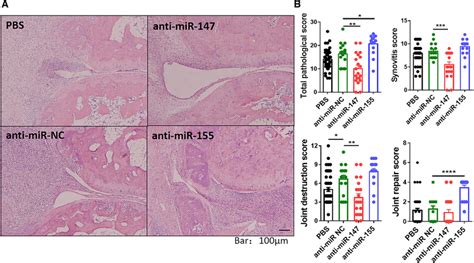 Effect of anti‐miR‐147 therapy in pristane‐induced arthritis on ...