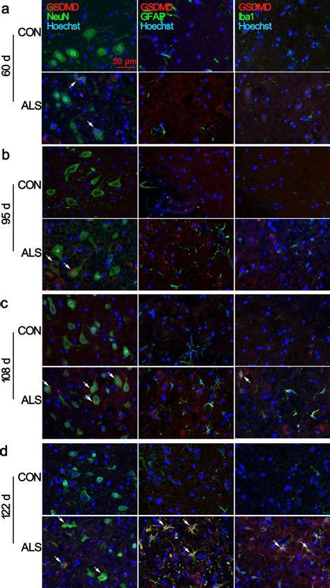 Increased Expression Of Gsdmd In Ventral Horn Neurons Of Als Mice